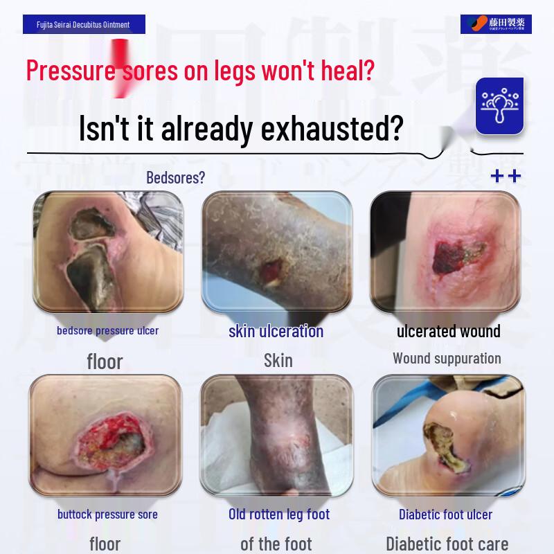 Fujita Pressure Sore Healing Cream