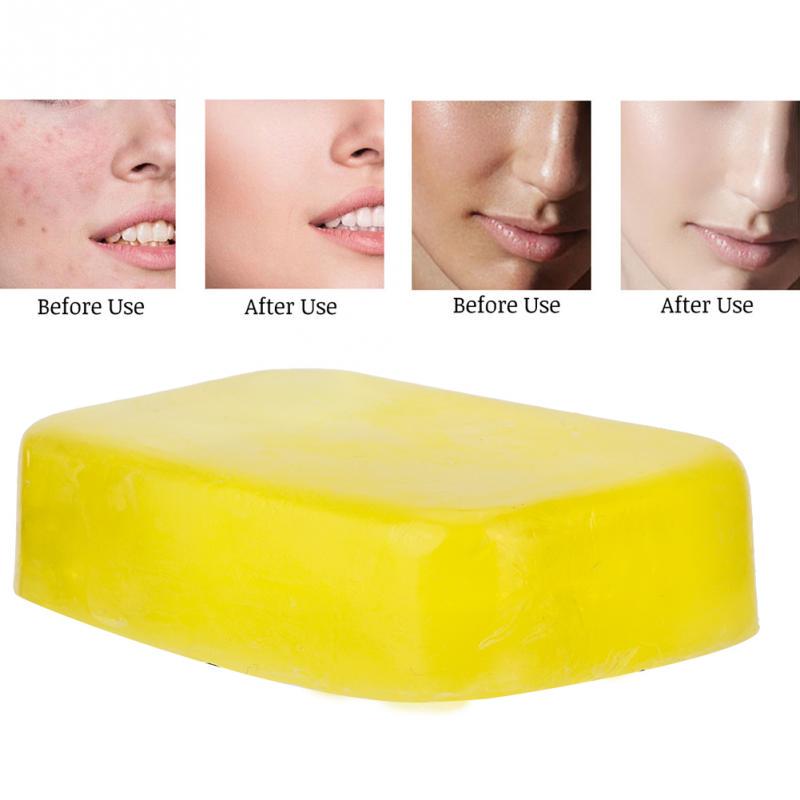 Buy Handmade Lemon Essential Oil Soap Nourishing Oilcontrol Whitening