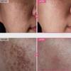 TOSOWOONG Krém s arbutinem 7 % a kyselinou tranexamovou 4 % 50 ml Rozjasňující K-Beauty 50g