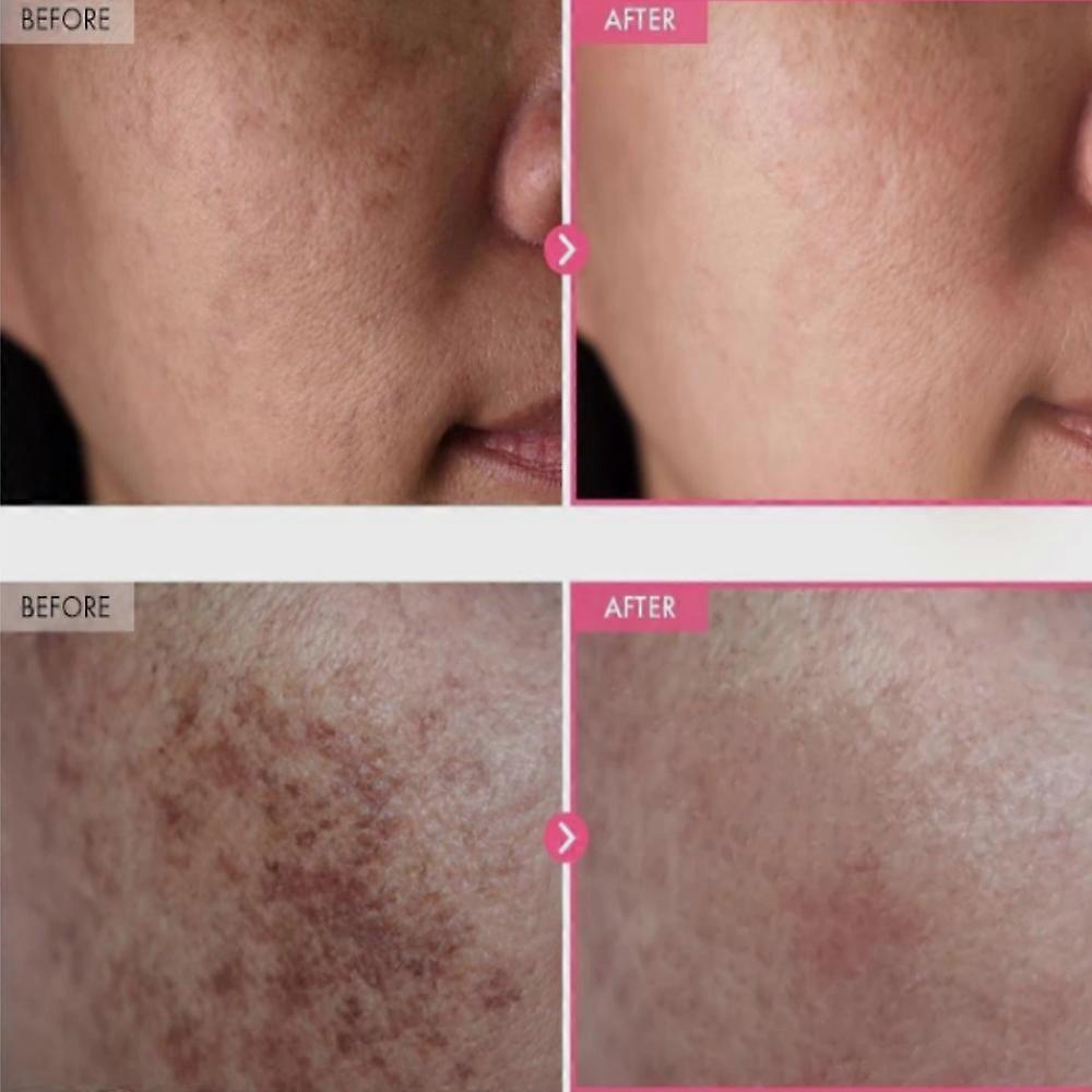 TOSOWOONG Krém s arbutinem 7 % a kyselinou tranexamovou 4 % 50 ml Rozjasňující K-Beauty 50g