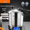 SUPOR 304 Stainless Steel Pressure Cooker