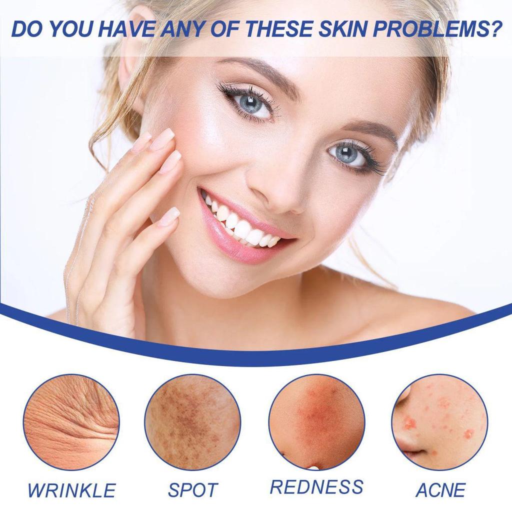 The Anti-wrinkle Moisturizing Cream Is Gentle and Non-irritating, Smoothing Wrinkles, Lightening Fine Lines and Leaving Skin Soft and Refined