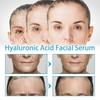 3 Stück Hyaluronsäure Gesichtsessenz 30ml Anti-Falten Haut Anti-Aging Straffend Feine Linien Feuchtigkeitsspendend