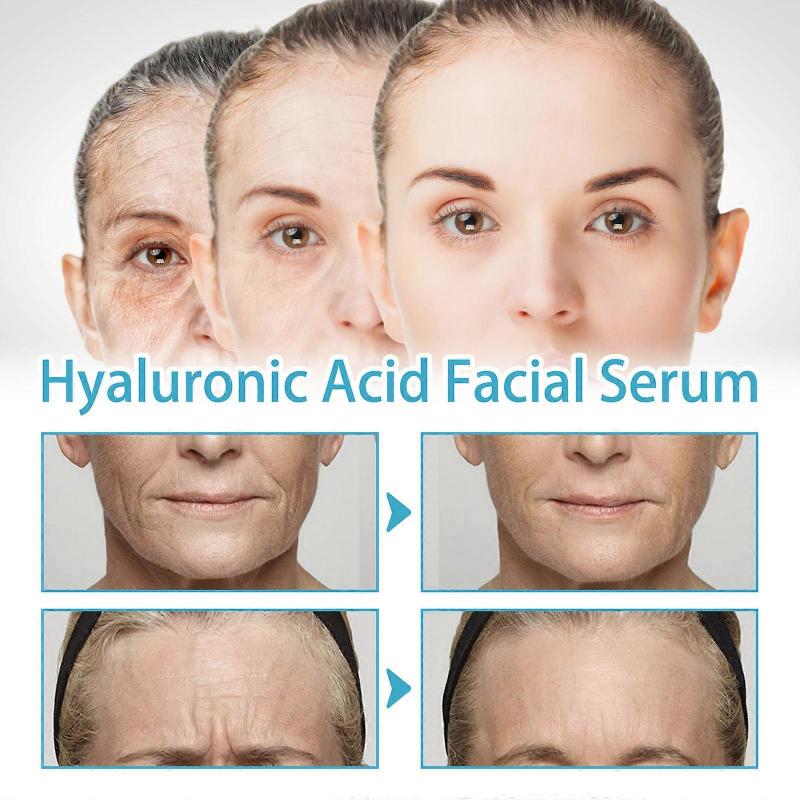 3 Stück Hyaluronsäure Gesichtsessenz 30ml Anti-Falten Haut Anti-Aging Straffend Feine Linien Feuchtigkeitsspendend