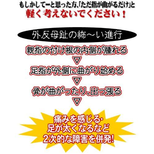 Sorbo Bunion/Humping Toe Support, Thin, Left, Medium