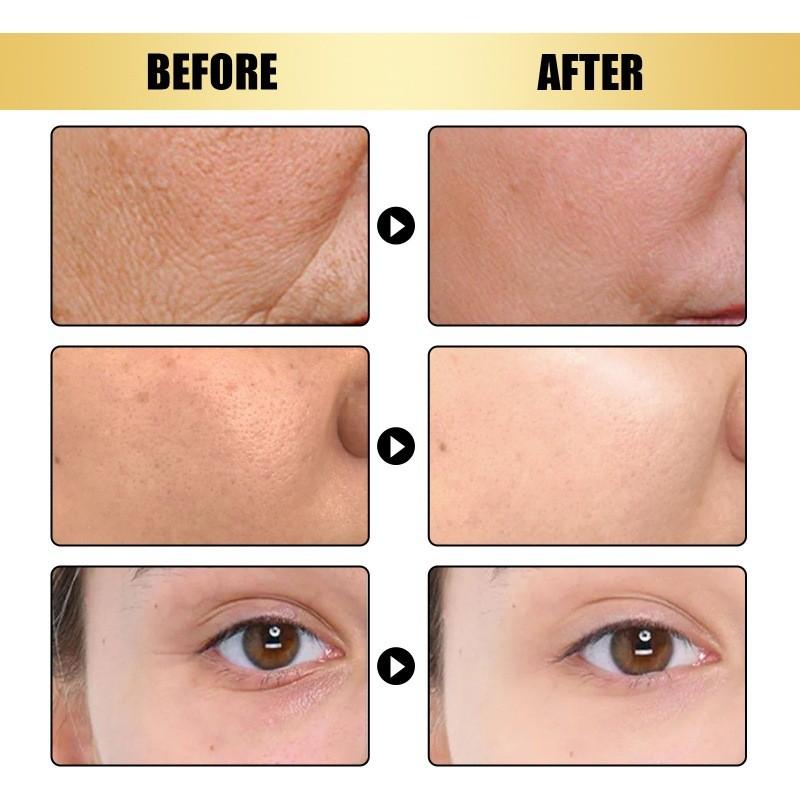 Hoygi 24k Gold Niacinamide Serum For Brightening And Hydrating Skin Texture And Tone