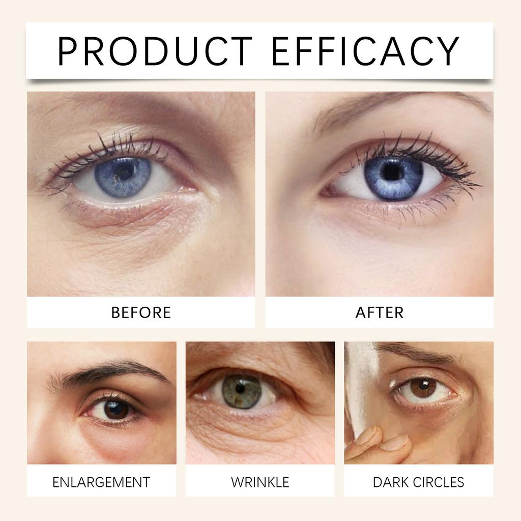 Caffeine Eye Liquid Is Gentle And Fine. It Moisturizes And Refreshes The Skin Around The Eyes And Reduces Dark Circles,30ML