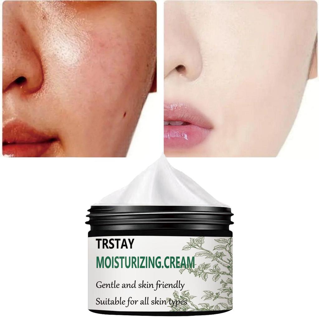 Gentle and Non-irritating, the Translucent and Blemish Moisturizing Cream Tightens the Skin, Brightens the Complexion