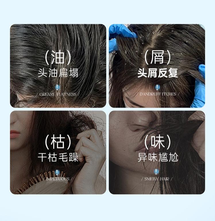 Yinqian Youth Shampoo with Oil Control and Fluffy Amino Acid Shampoo Gel