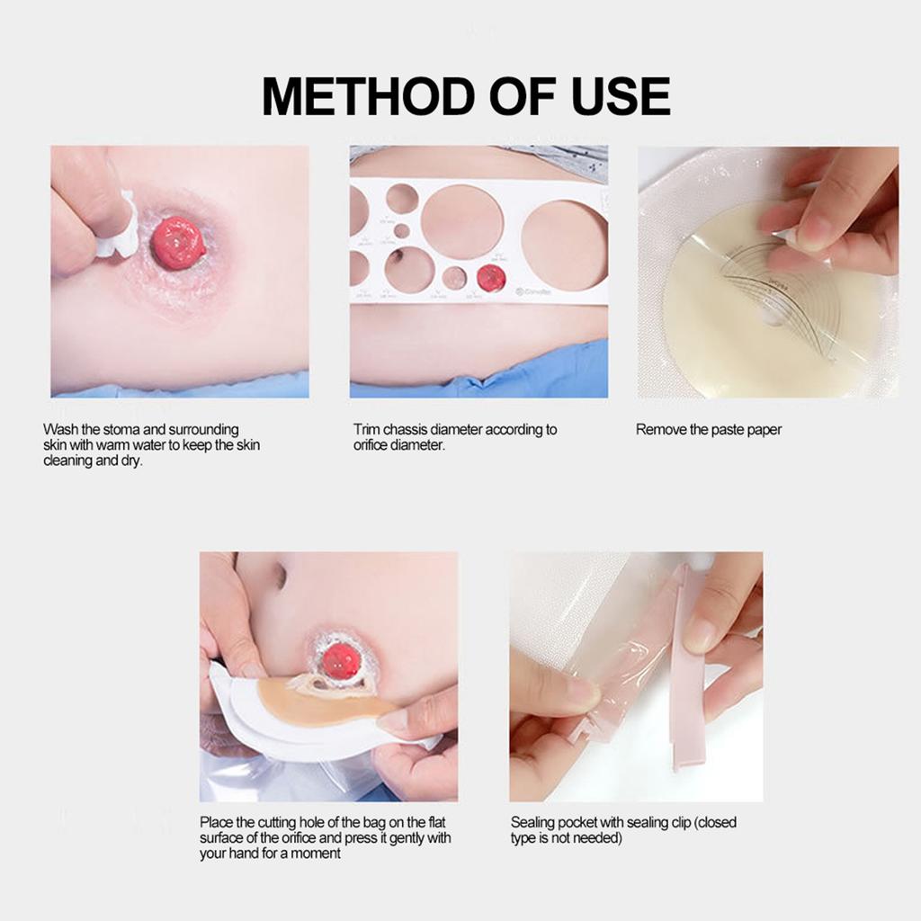 10pcs Disposable Colostomy Bag Soft Skin Friendly Colostomy Pouch Bag(Open Type )
