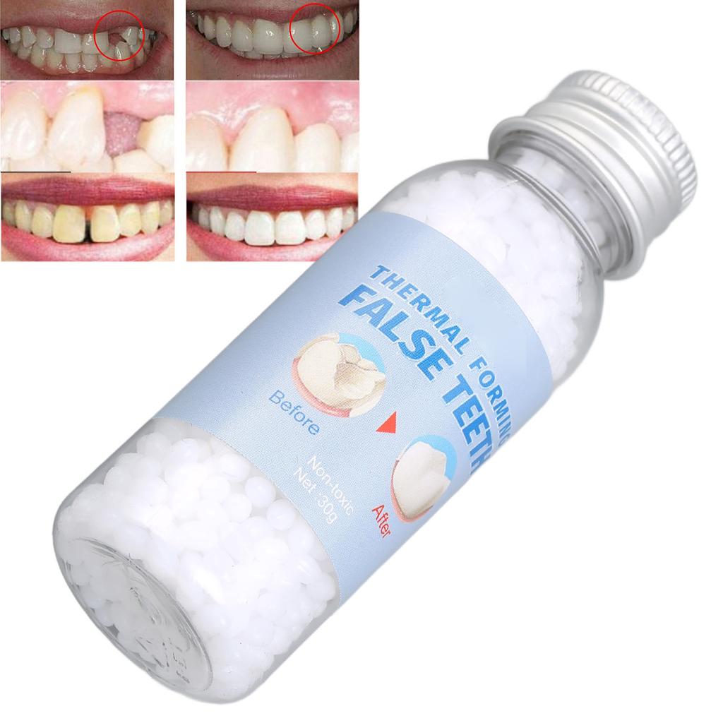 Tooth Repair Glue Safe Material Simple Operation Dental Care Glue Kit for Dental Restoration