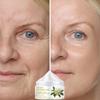 Essence Cream To Reduce Fine Lines, Smooth Wrinkles and Improve Damaged Skin