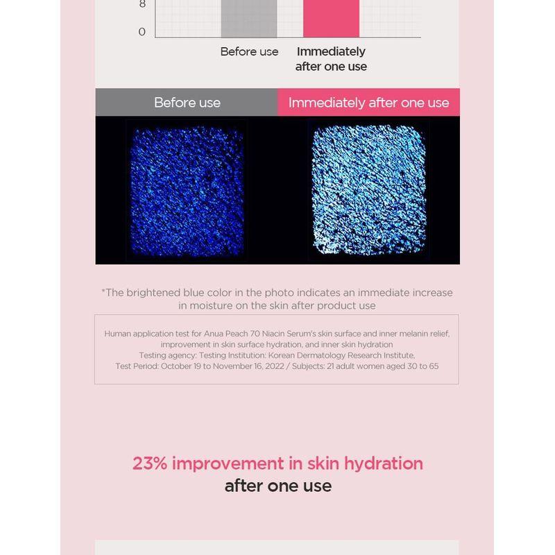 Anua Peach 70 Niacin Serum