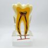 Dental Nerve Model - Tooth Structure Display, Cross-section Analysis, 6x Magnification for Oral Teaching