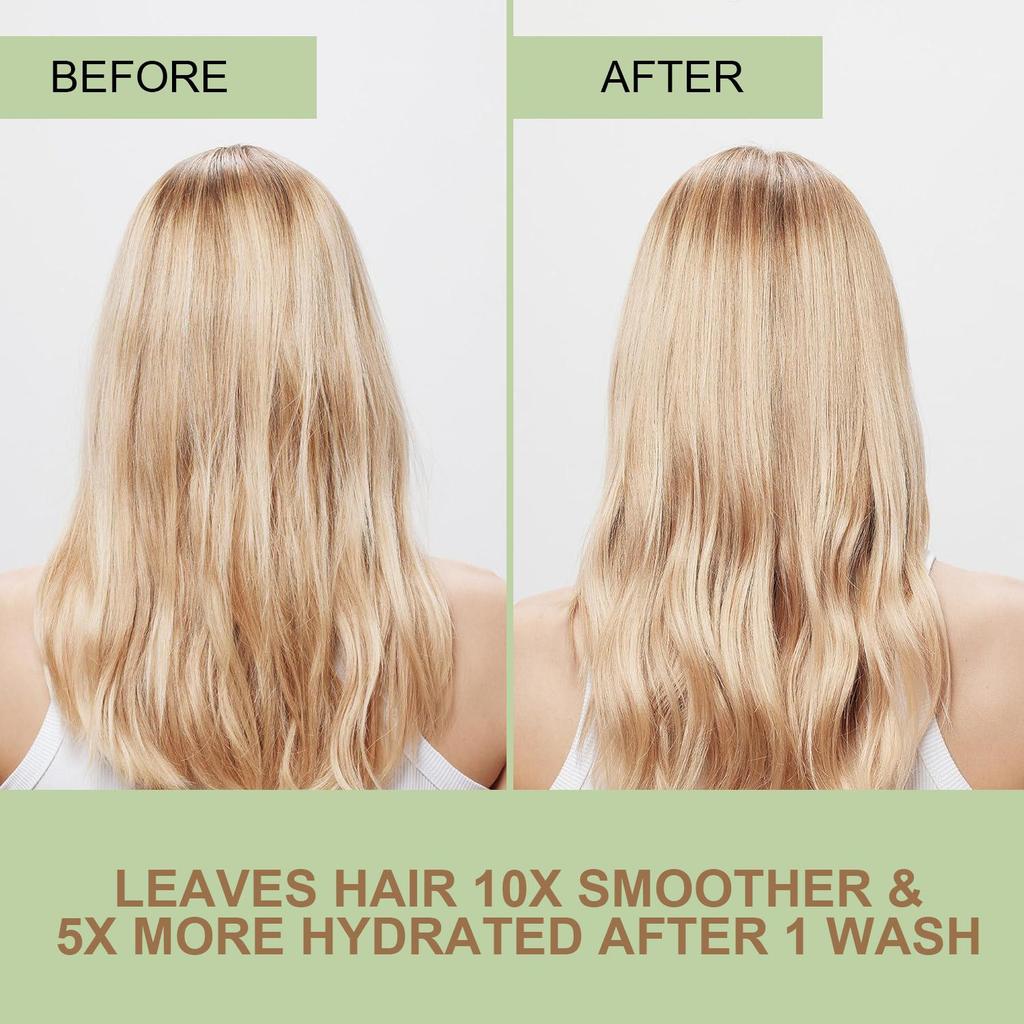 Onion Biotin Shampoo Bar Soap-Cleanse And Smooth Hair With Onion, Rosemary And Citric Acid-Moisturizes Dry, Brittle Hair, 100g