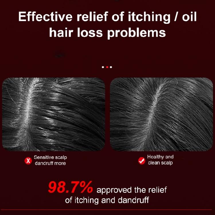 Scalp Massage Comb Massager Brush Electric Vibrations Massage Comb with 3 Massage Mode Hair Oil Applicator Brush