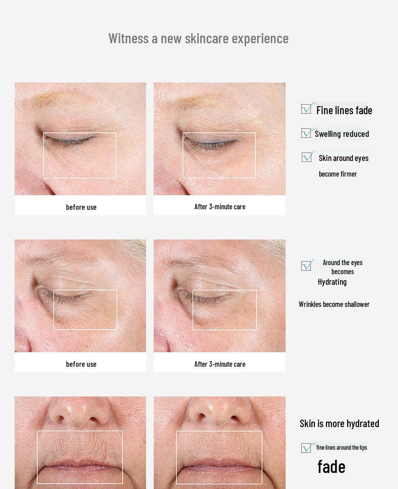 Eye Massager: Reduces Eye Bags, Fine Lines with Cold Compress & Vibration