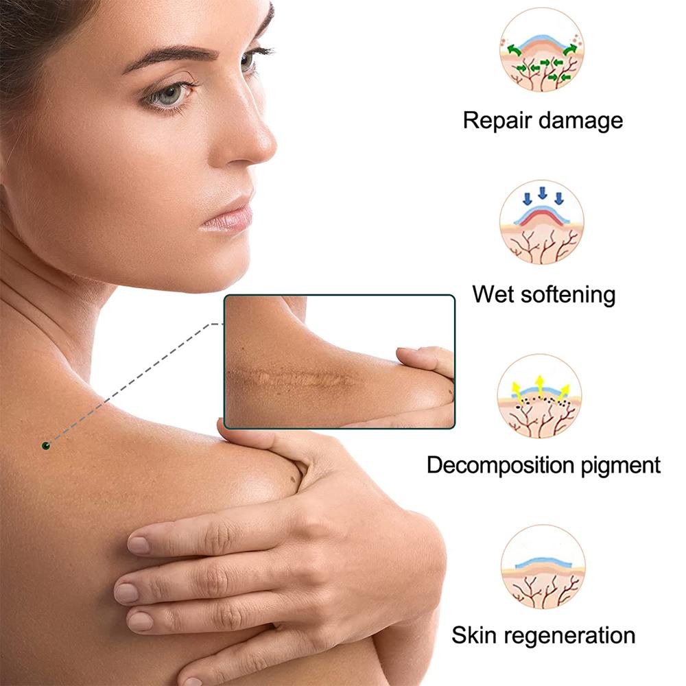 1 Roll Easy-Tear Silicone Gel Tape Roll - Medical Grade Wound Dressing, Sticky Bandage, Latex-Free, Adhesive, Soft Flexible