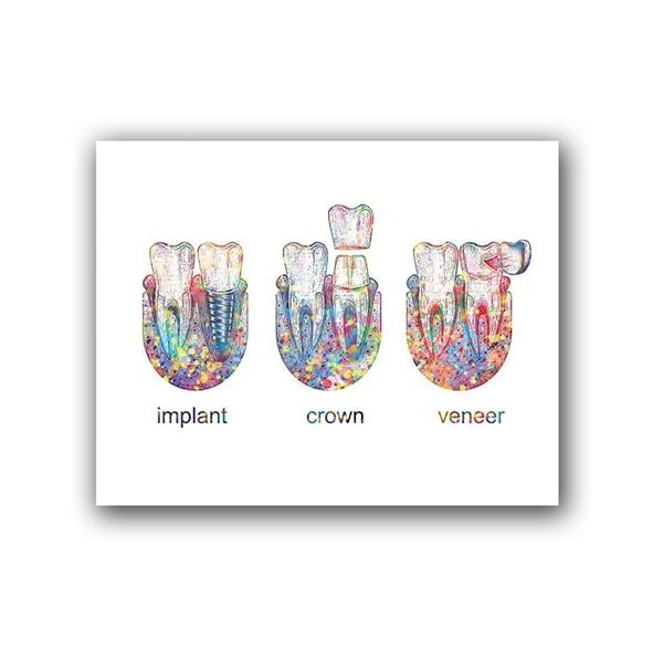 

My Chemical Romance Wall Art Современный скандинавский домашний декор Плакат Зубной имплантат Коронка Картина для дизайна комнаты Граффити Картина без рамки 21*30cm No Frame