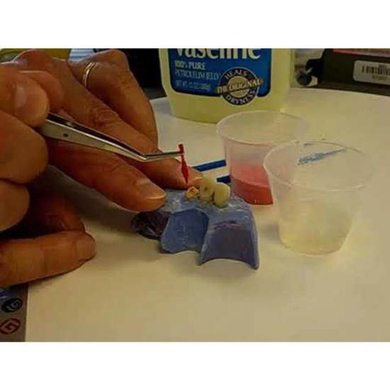 GC Pattern Resin 1-1 Package