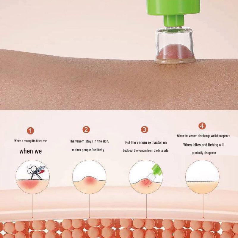 Přenosný extraktor jedu: První pomoc při bodnutí hmyzem a úleva venku