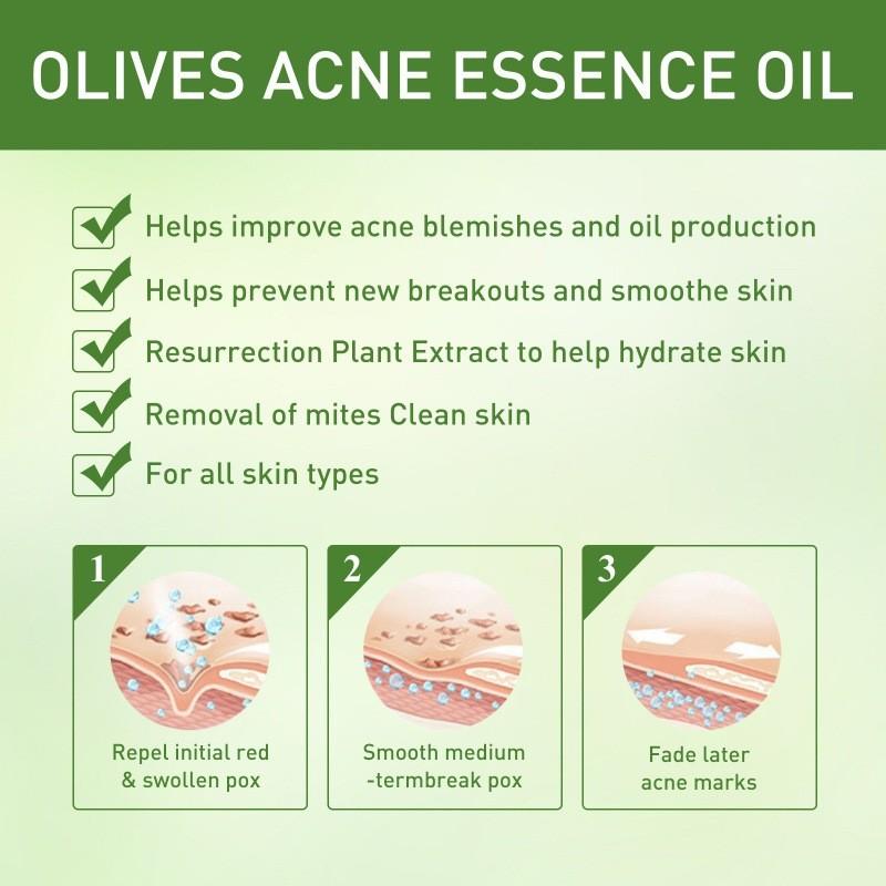 Jaysuing Essential Oil For Gentle Moisturizing And Acne Scar Repair 30ml