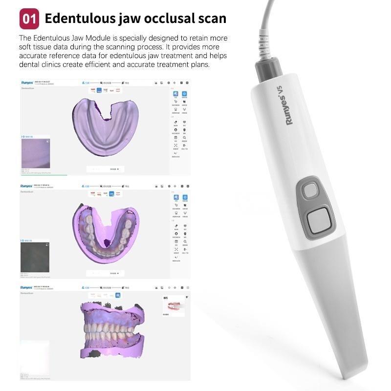 

Runyes 3DS V5 Pro Внутрішньоротовий стоматологічний сканер Цифровий стоматологічний наконечник 3D-моделювання зубів AI-сканер білий