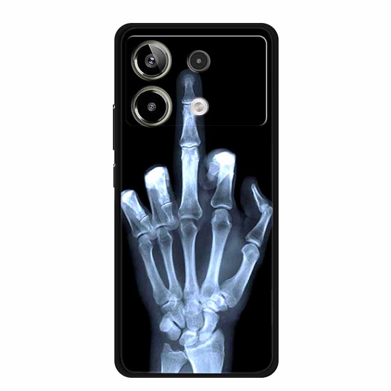 For Redmi Note 13R Pro Case Animals Soft Silicone TPU Phone Cases Back Cover For Xiaomi Redmi Note13R Pro Wolf Protector fundas