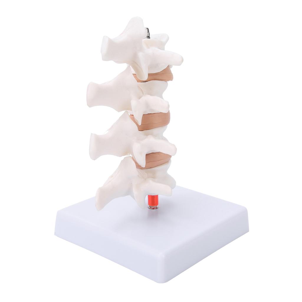 Professionelles Osteoporose-Modell, menschliches anatomisches Wirbelsäulenmodell für die Lehrdemonstration