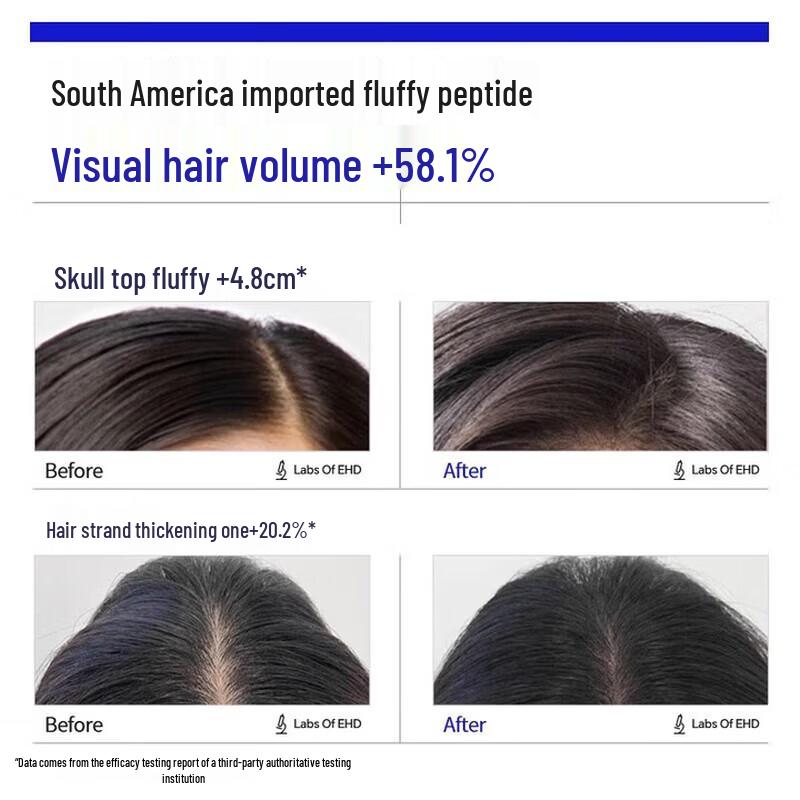 EHD Multi-Dimensional Volumizing & Anti-Hair Loss Shampoo Set