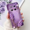 For Honor Magic 7 Lite Case BRP-NX1 2025 New Luxury Painted Cover Clear Silicone Soft Slim Phone Case For Honor Magic7 Lite Bags