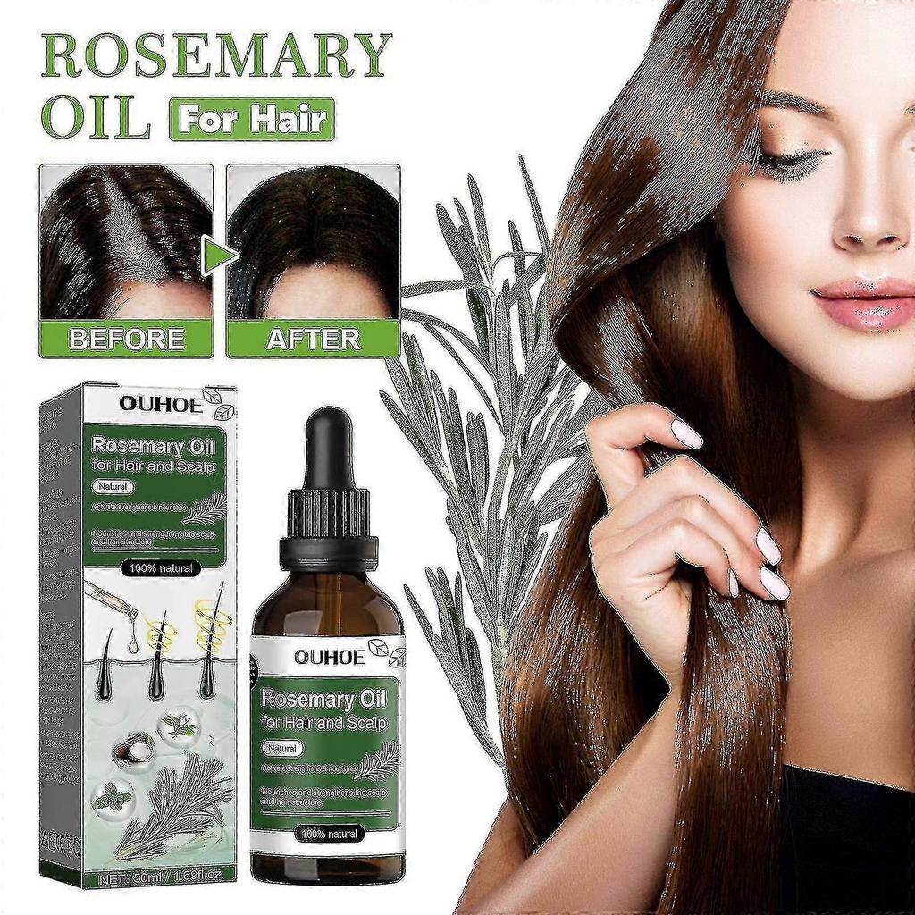 Ouhoe Rosemary Oil For Hair And Scalp Fast Rosemary Black Seed Essential Oils Oil Spray For Hair Care And Growth |  |