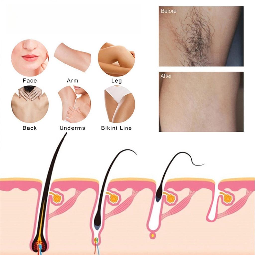 Hair Removal Spray, Hair Removal Spray Gentle Hair Removal Is Suitable For Both Men And Women,220ML