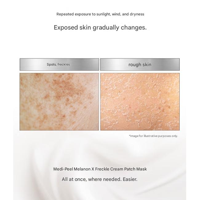 MEDI-PEEL Melanon X Blemish Cream Maska w plastrach 1 para (2 arkusze · 3,5 g) /  Krem na niedoskonałości pod oczy 20ml (11 Opcje)