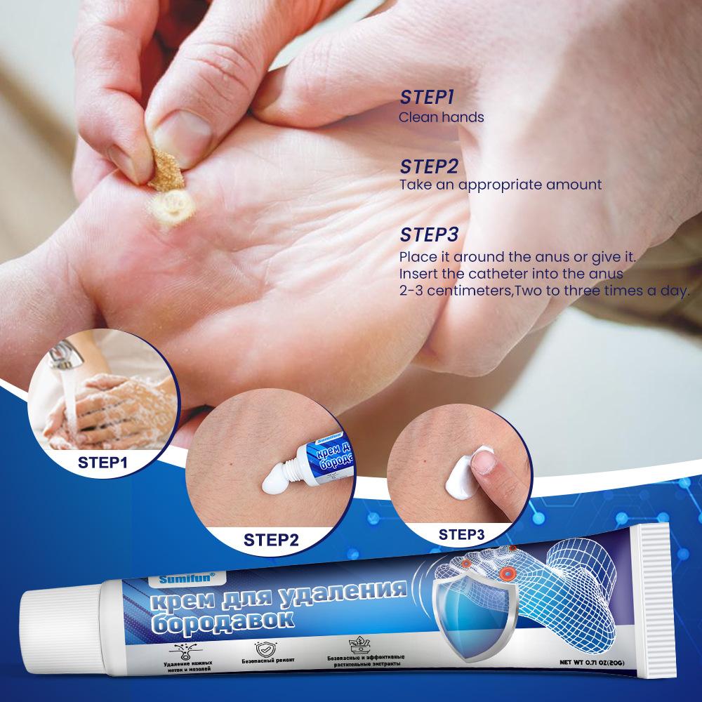 20G Foot Corn Removal Killer Foot Protection Pain Relief Curative Cream Medical Corns Plaster