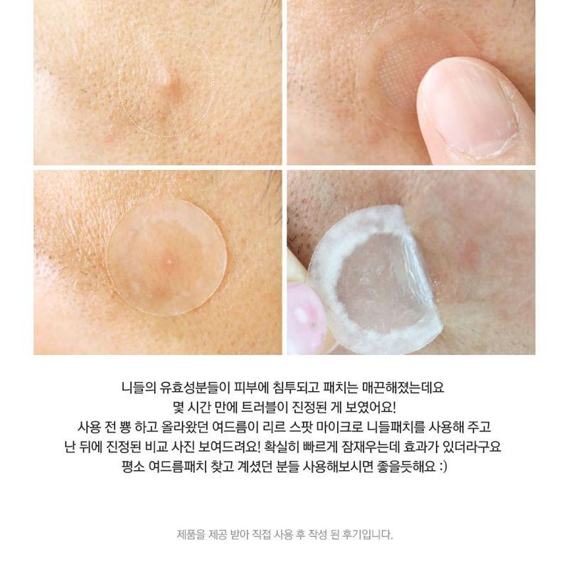 RiRe - Red Spot Micro Needle Patch