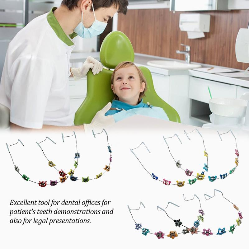 1Pair Cartoon Dental Metal Braces Archwire Without Hooks Metal Bracket And Ligature Ties Colorful Temporary Tooth Decoration
