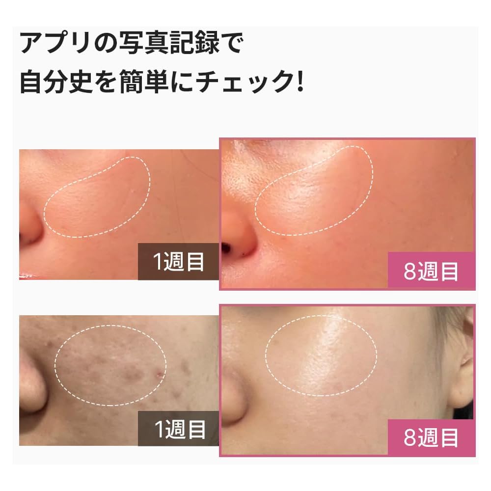 Medicube AGE-R Booster Pro Różowy, 5-minutowe koreańskie doświadczenie pielęgnacji skóry, Japońska instrukcja obsługi, Wszechstronne urządzenie do pielęgnacji twarzy, Przenośne, 155g, Gi