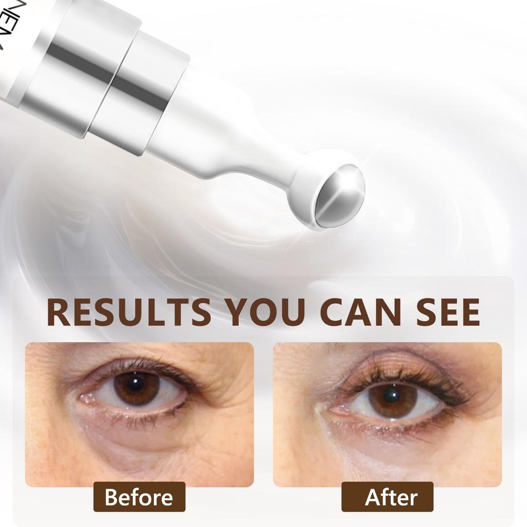 Under Eye Cream-Hydration And Nourishment With Coffee Oil & Vitamin E-Lightweight Moisturizing no Greasy-Suitable For All Skin Types, 15ml