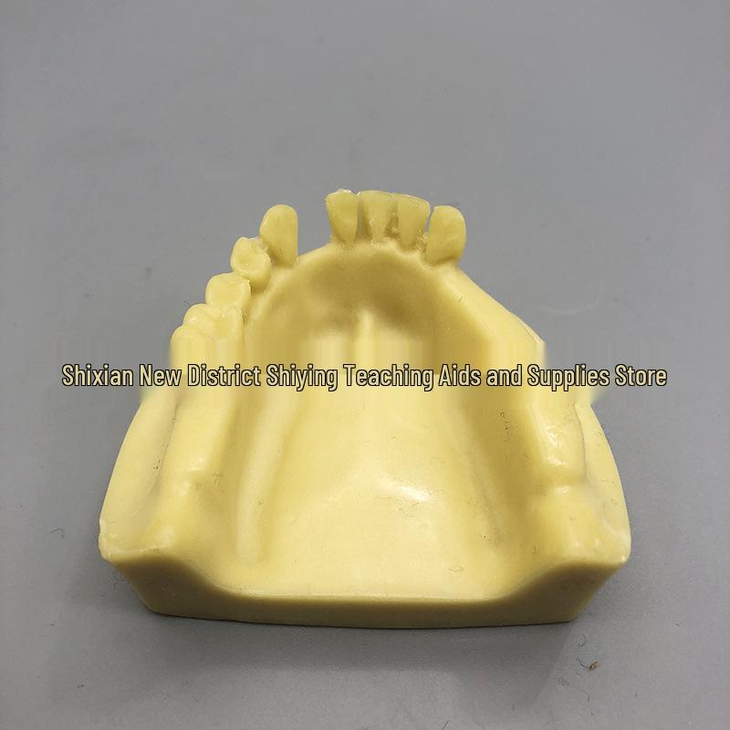 Dental Mandible Implant Practice Model with Missing Tooth for Student Dentists 2028
