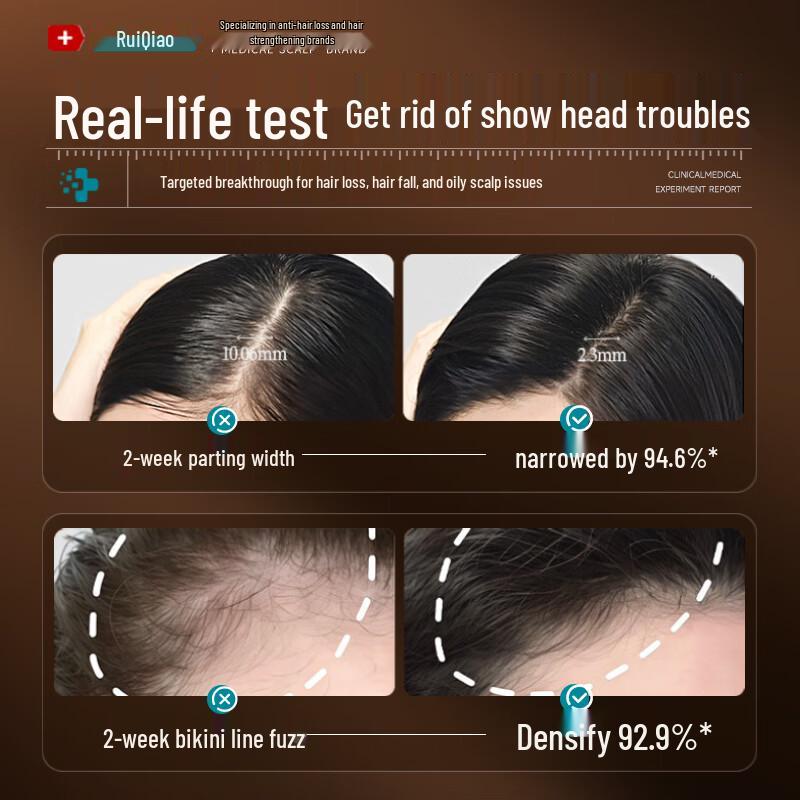 FIVERAMS Anti-Hair Loss Shampoo with Ginger & Arborvitae Leaf, 500ml