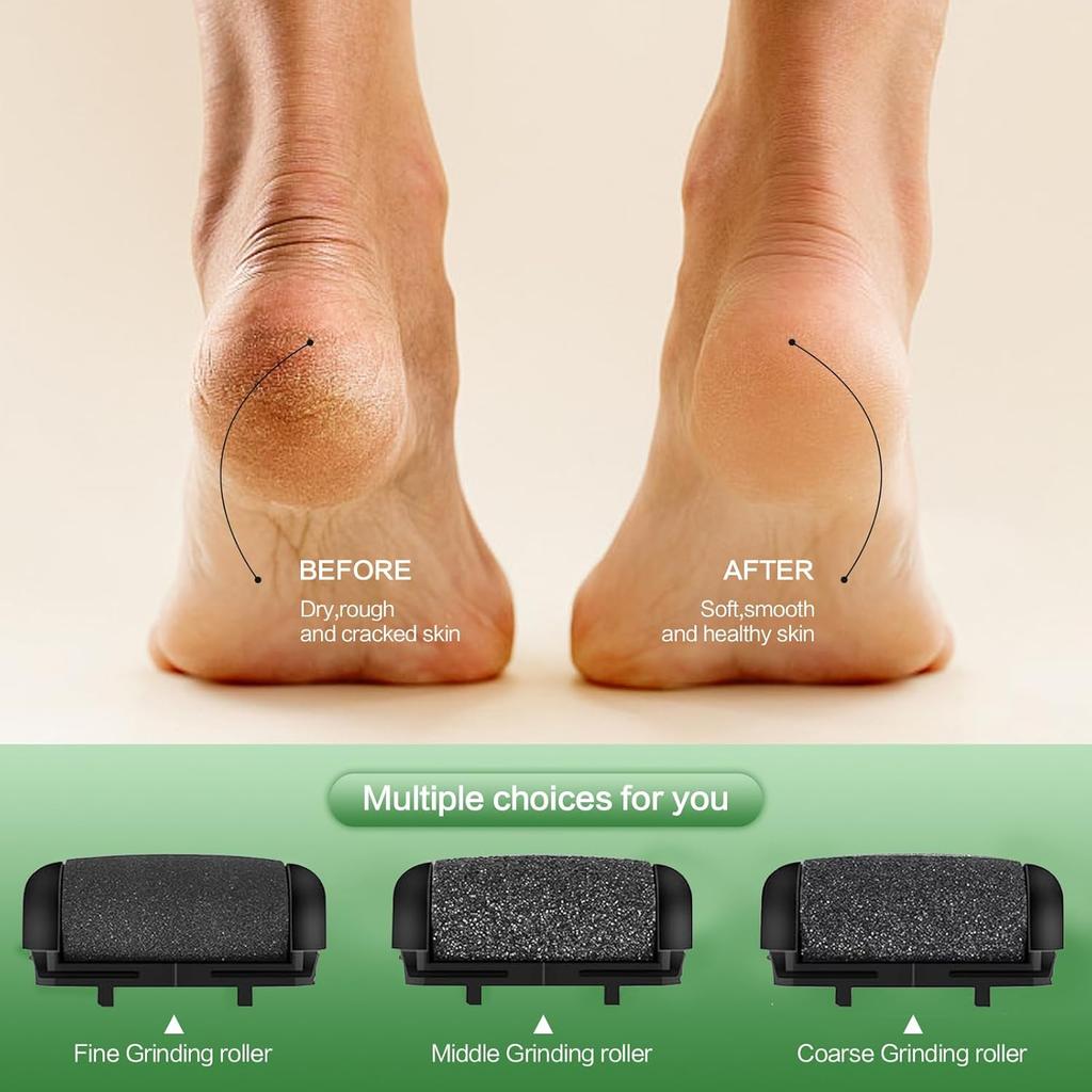 Electric Foot Callus Remover, LED Light & Display Electric Foot File, Rechargeable Waterproof Electric Foot Filer, 3 Replacement Rollers & USB-C