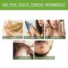 3pcs Rosemary Essential Oil for Hair Growth & Skin Care, Tough Hair Nourishing Hair Repair Damage Hair