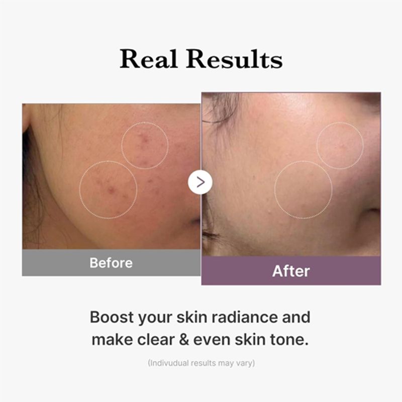 Medicube AGE-R Glutathion Glow Toner 140ml