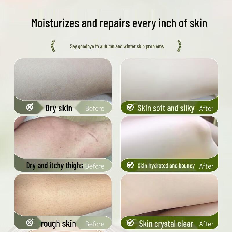 HIEUAILR Moisturizing & Anti-Itch Shower Gel