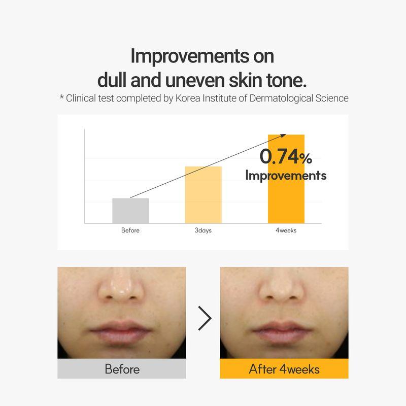 [Rovectin] Vita Dark Spot Serum 30ml