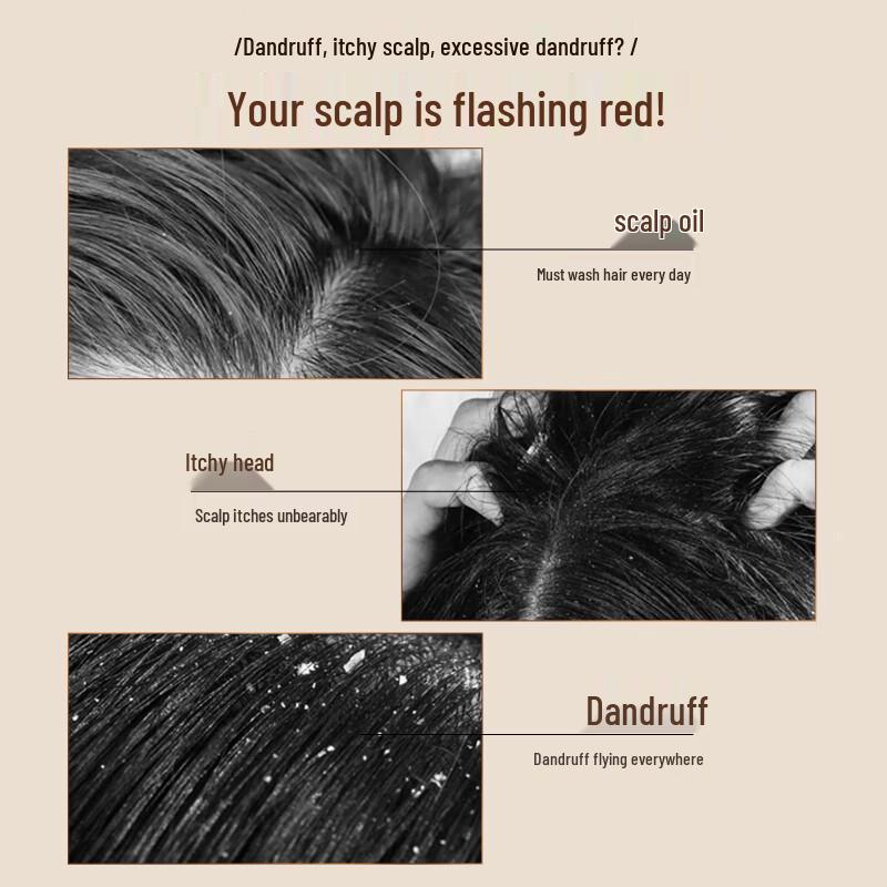 Ziyuan Amino Acid Tea Seed Anti-Dandruff Shampoo