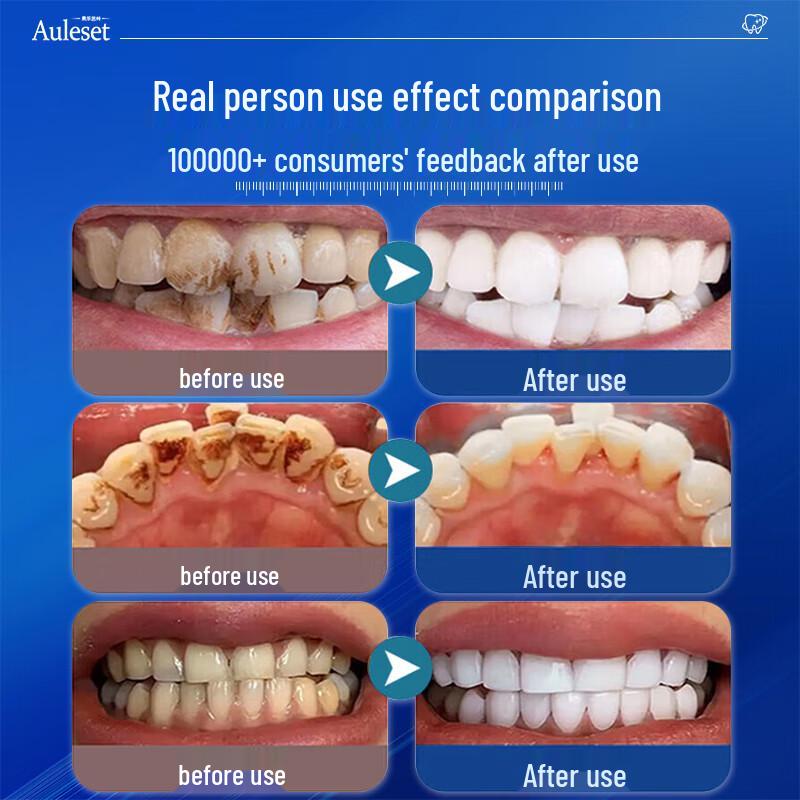 LEKKI Beyazlatıcı & Tartar Kontrolü Diş Macunu