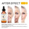 Vitamin C Serum für Gesichtsaufhellung Gesichtsserum Hyaluronsäure Dunkle Fleckenentferner Hautpflege