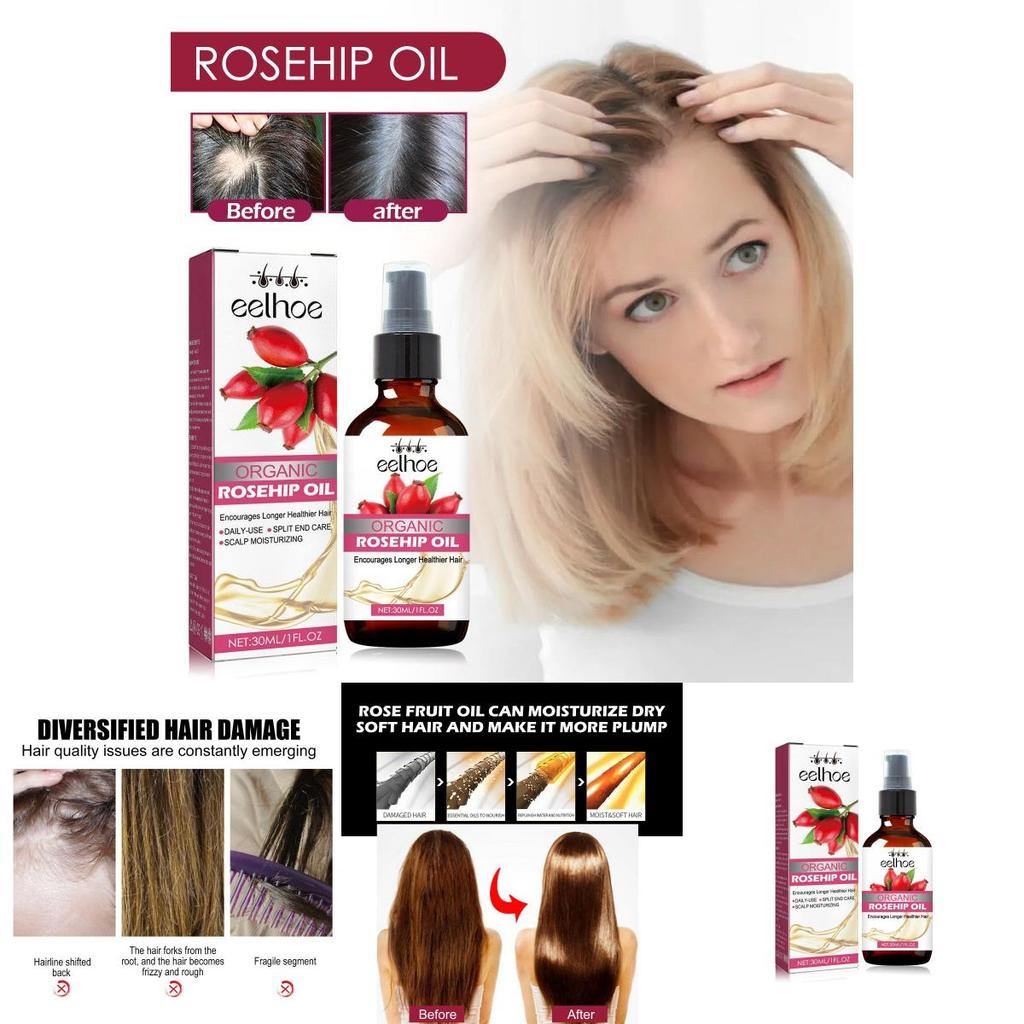 Eelhoe Nourishing Rosehip Oil For Hair Moisturizing And Strengthening 30ml Bottle